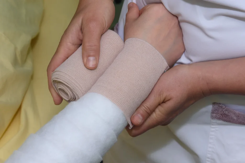 In der intensiven Entstauungsphase findet die Manuelle Lymphdrainage in der Regel an fünf Tagen pro Woche statt, meist einmal täglich, in ausgeprägten Fällen auch zweimal. Diese Phase dauert mindestens zwei Wochen, häufig zwei bis vier, bei schweren Ödemen auch sechs bis acht Wochen. Nach jeder Behandlung wird ein mehrlagiger Kompressionsverband mit Kurzzugbinden angelegt. Er wird täglich etwa 18 bis 22 Stunden getragen und verhindert, dass sich die Flüssigkeit bis zur nächsten Sitzung wieder ansammelt. Ohne diesen Verband ginge ein grosser Teil des Behandlungserfolgs verloren. Bandagiert wird, bis das Ödem sein Minimum erreicht hat. Dann wird im Sanitätsfachgeschäft Mass genommen für eine flachgestrickte Kompressionsversorgung, also einen Strumpf, einen Armstrumpf oder einen Handschuh, der exakt der Form Ihres Körpers folgt. Bis diese Versorgung fertig ist, wird weiter bandagiert, damit das erreichte Ergebnis erhalten bleibt. Danach wird sie nach der Lymphdrainage und der Hautpflege angezogen.